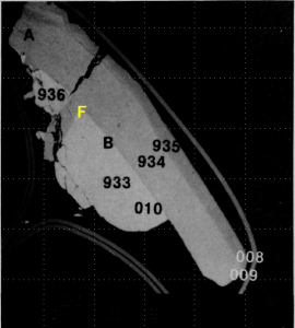 図18(b)　7B粒子のBSI