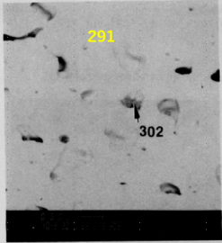 図26(c)　領域-2の拡大BSI