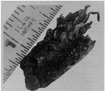 図11(b) 溶融凝固層中の金属デブリ粒子の外観 [2]